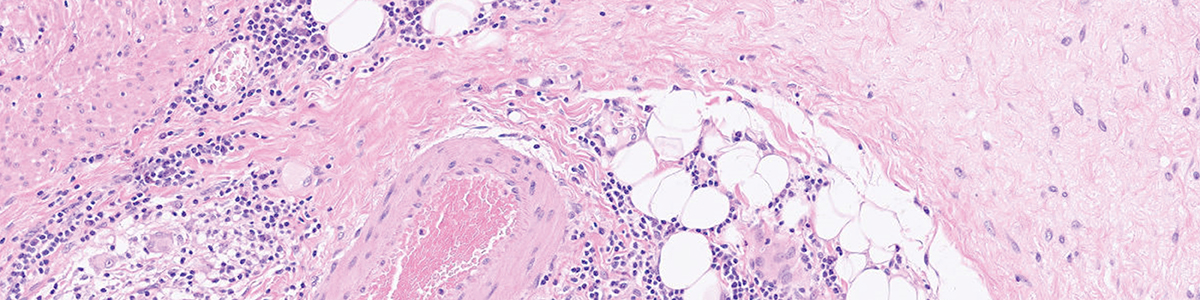 web_billede_pink_1200x300px